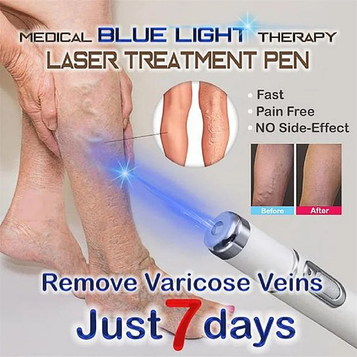 Blue Light Therapy Laser Treatment Pen Facial Massager Acne Soft Scar Wrinkle Removal droshipping
Blue Light Therapy Laser Treatment Pen Facial Massager Acne Soft Scar Wrinkle Removal droshipping