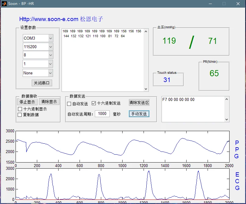 Heart Rate Blood Pressure Sensor Module Highly Integrated Continuous Heart Rate Detection Blood Pressure Monitoring Program
Heart Rate Blood Pressure Sensor Module Highly Integrated Continuous Heart Rate Detection Blood Pressure Monitoring Program