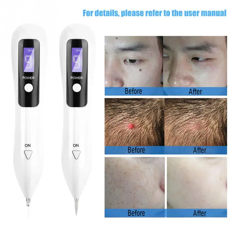 9 level LCD Face Skin Dark Spot Remover Mole Tattoo Removal Laser Plasma Pen Machine Facial Freckle Tag Wart Removal Beauty Care
9 level LCD Face Skin Dark Spot Remover Mole Tattoo Removal Laser Plasma Pen Machine Facial Freckle Tag Wart Removal Beauty Care