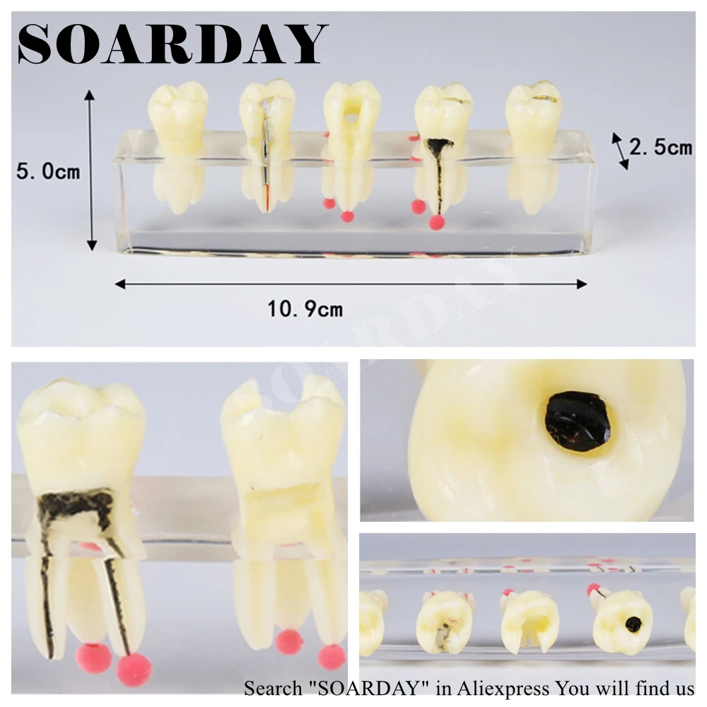 SOARDAY Tooth Root Canal Restoration Model Oral Dental Training Materials Tooth Nerve Model
SOARDAY Tooth Root Canal Restoration Model Oral Dental Training Materials Tooth Nerve Model