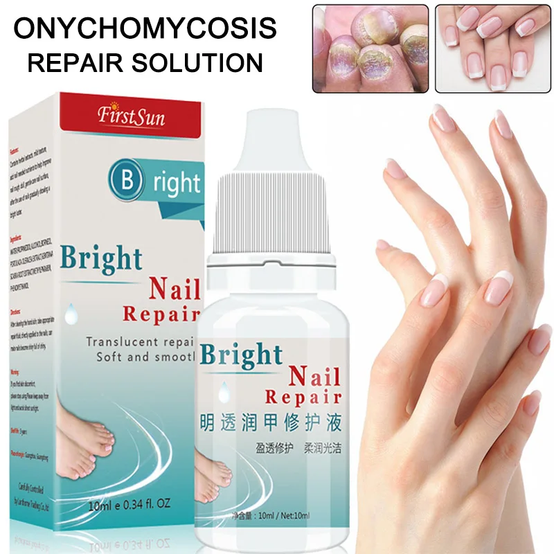 10ml Nail Fungal Treatment Anti Fungus Onychomycosis Removal Toenail Care Nails Repair Liquid MH88
10ml Nail Fungal Treatment Anti Fungus Onychomycosis Removal Toenail Care Nails Repair Liquid MH88