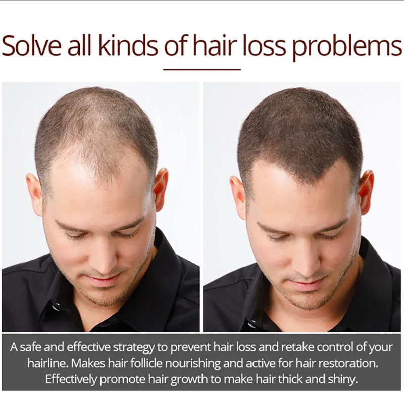 Hair Growth Essence Hair Loss Liquid Natural Pure Original Essential Oils 30ML Dense Hair Growth Serum Health Care Beauty
Hair Growth Essence Hair Loss Liquid Natural Pure Original Essential Oils 30ML Dense Hair Growth Serum Health Care Beauty
