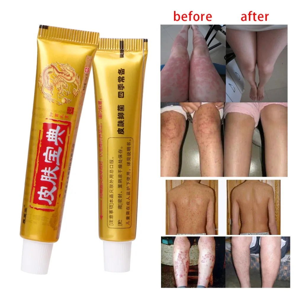 Natural Chinese Medicine Herbal Anti Bacteria Cream Psoriasis Eczema Ointment Treatment
Natural Chinese Medicine Herbal Anti Bacteria Cream Psoriasis Eczema Ointment Treatment
