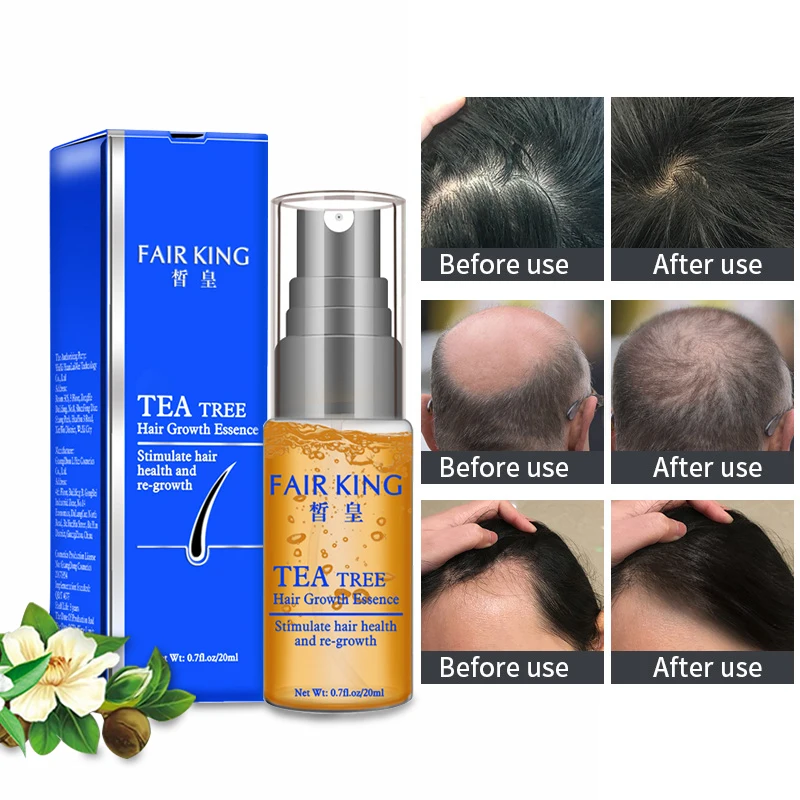 Fast Powerful Hair Growth Essential Oil Organic Natural Hair Loss Care Serum 20ML Hair Scalp Treatment Essence Tea Tree Extract
Fast Powerful Hair Growth Essential Oil Organic Natural Hair Loss Care Serum 20ML Hair Scalp Treatment Essence Tea Tree Extract