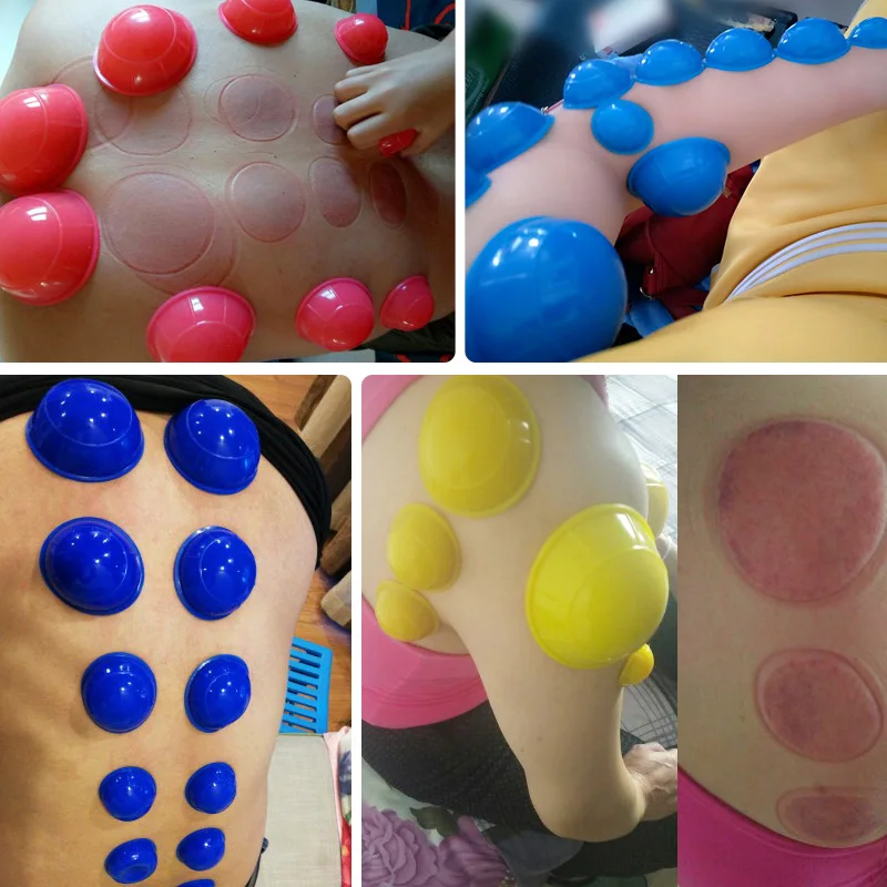 SHARE HO 12pcs Silicone Massage Jars Cupping Set Chinese Therapy Body Massager Banks Anti Cellulite Vacuum Cans
SHARE HO 12pcs Silicone Massage Jars Cupping Set Chinese Therapy Body Massager Banks Anti Cellulite Vacuum Cans