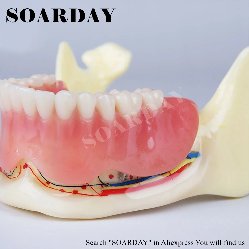 High Quality Resin Lower Jaw Denture Coverage Model Mandibular Nerve Model Display Denture Removable
High Quality Resin Lower Jaw Denture Coverage Model Mandibular Nerve Model Display Denture Removable