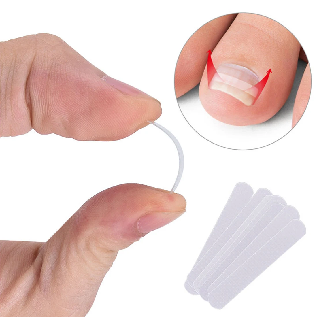 New Ingrown Toe Nail Correction Sticker Patch Paronychia Corrector File Elastic Foot Care Treatment Pedicure | Красота и здоровье