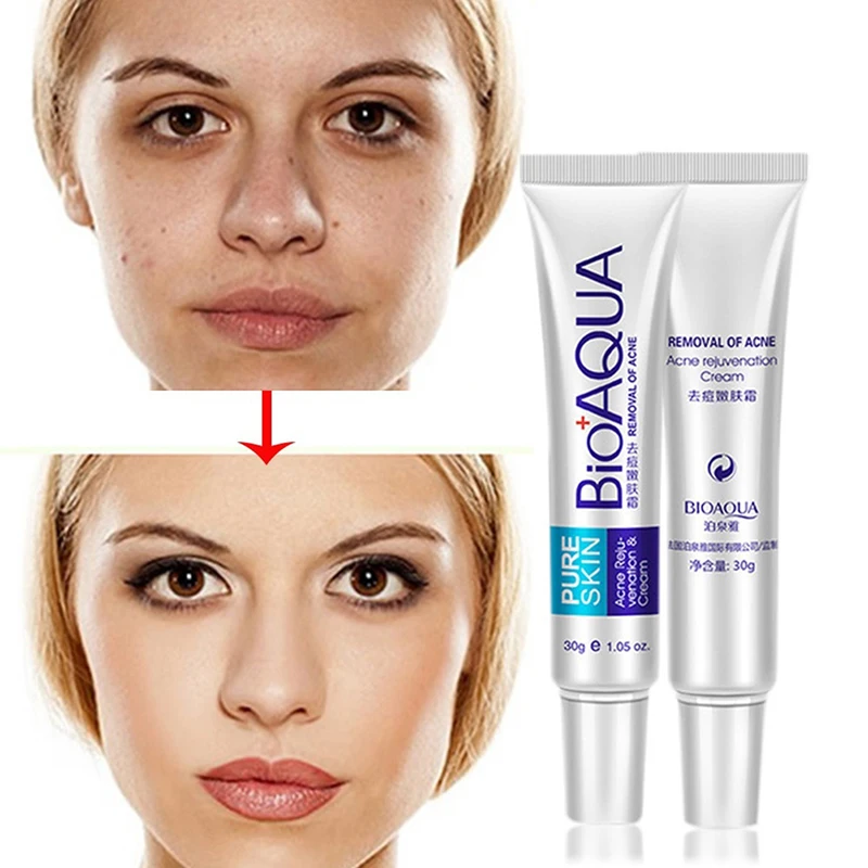 1pc Acne Cream Blackhead Acne Scar Removal Anti Acne Cream Oil Control Face Care Whitening Effective Face Skin Care
1pc Acne Cream Blackhead Acne Scar Removal Anti Acne Cream Oil Control Face Care Whitening Effective Face Skin Care