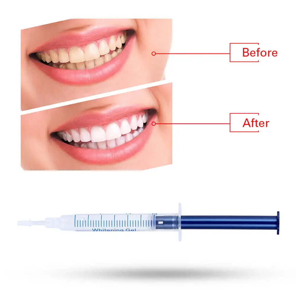 New 20 Pcs Teeth Whitening Gel Safe Carbamide Peroxide Dental Cleaning Tooth Whitener Dental Equipment 40% CP
New 20 Pcs Teeth Whitening Gel Safe Carbamide Peroxide Dental Cleaning Tooth Whitener Dental Equipment 40% CP