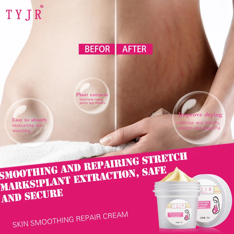 Stretch Marks Repair Cream Remove Pregnancy Scars Acne Treatment Maternity Anti-Aging Anti Winkles Firming Body Creams
Stretch Marks Repair Cream Remove Pregnancy Scars Acne Treatment Maternity Anti-Aging Anti Winkles Firming Body Creams