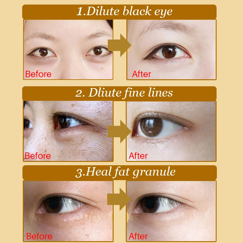 Crystal Collagen Eye Mask Eye Patches Sleep Mask Dark Circle Fine Lines Anti-Aging Wrinkle Firming for Eye Care 40pcs=20pair
Crystal Collagen Eye Mask Eye Patches Sleep Mask Dark Circle Fine Lines Anti-Aging Wrinkle Firming for Eye Care 40pcs=20pair