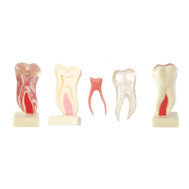 6 Times Anatomic Profile Model of Mandibular Molar dental teeth teaching Model
6 Times Anatomic Profile Model of Mandibular Molar dental teeth teaching Model