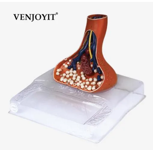 Brand New Enlarged Nerve Endings/terminal Synapse Model 107