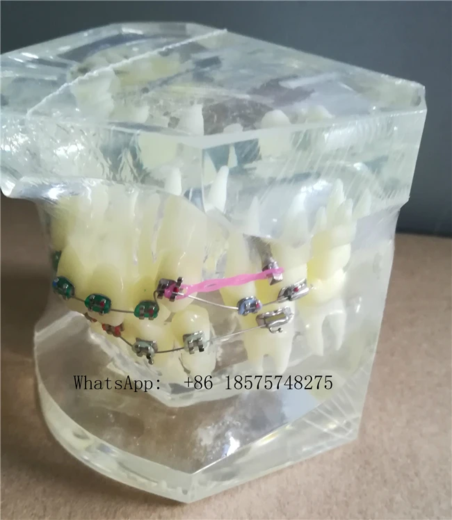 Dental Malocclusion Tth Model Orthodontic Model for Patient Communication Dental Study tooth Model with bracket power chain
Dental Malocclusion Tth Model Orthodontic Model for Patient Communication Dental Study tooth Model with bracket power chain
