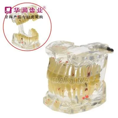 Dental teaching model Adult pathology teeth model free shipping