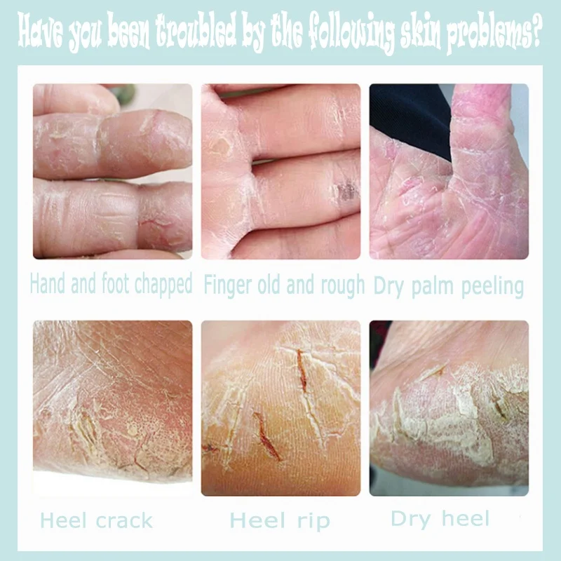 20g Heel Chapped Peeling Skin Repair Creams Moisturizing Anti-Drying Anti-Crack Feet Hand Skin Care Cream Drop Shipping
20g Heel Chapped Peeling Skin Repair Creams Moisturizing Anti-Drying Anti-Crack Feet Hand Skin Care Cream Drop Shipping