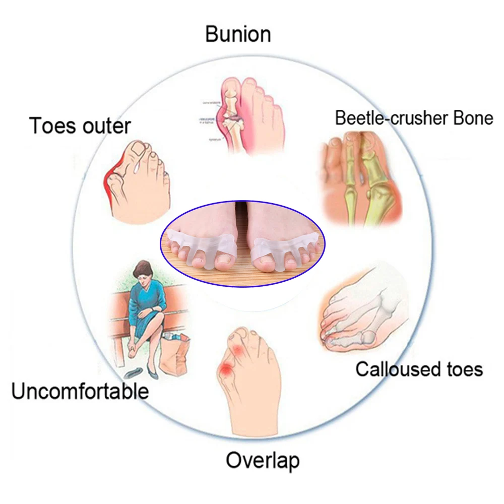 1 Pair Gel Silicone Bunion Protector Big Toe Separators Straightener Protector Foot Care massage Hallux Valgus Protector Z32701
1 Pair Gel Silicone Bunion Protector Big Toe Separators Straightener Protector Foot Care massage Hallux Valgus Protector Z32701