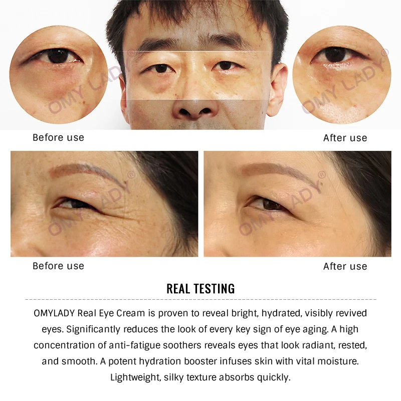 2019 New Natural Multi-effect Eye Cream Moisturizing Nourishing Remove Wrinkle Dryness and Dark Circles Eye Bags Eye Cream
2019 New Natural Multi-effect Eye Cream Moisturizing Nourishing Remove Wrinkle Dryness and Dark Circles Eye Bags Eye Cream