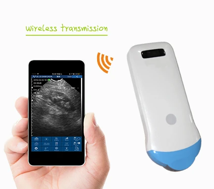 Wireless ultrasound micro convex array probe Uprobe with Reverse harmonic function
Wireless ultrasound micro convex array probe Uprobe with Reverse harmonic function