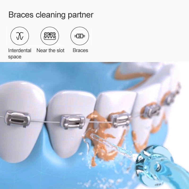 Xiaomi Oral Irrigator Set With 4 Tips Portable Water Dental Flosser Water Jet Clean Tooth Denture Cleaner Teeth Brush
Xiaomi Oral Irrigator Set With 4 Tips Portable Water Dental Flosser Water Jet Clean Tooth Denture Cleaner Teeth Brush