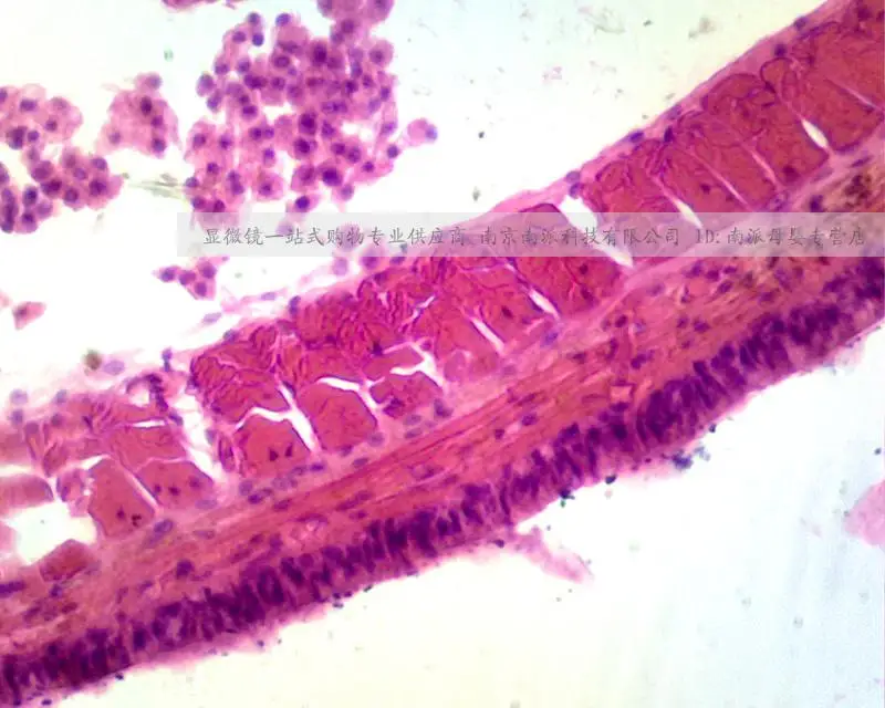 1.3 megapixel microscope eyepiece Lens interface 23.2mmmegapixel mobile phone computer can be accessed by computer OTG mobile
1.3 megapixel microscope eyepiece Lens interface 23.2mmmegapixel mobile phone computer can be accessed by computer OTG mobile