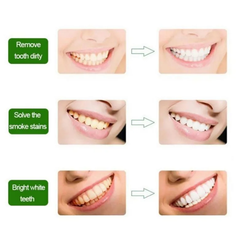 Tooth Whitening Powder Yellow Smoke Stains Bright Whiteg Black Cleaner Toothpaste T9 | Красота и здоровье