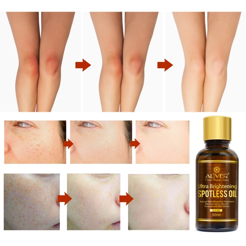 1pc Makeup Rose Essential Oil Lighten Melanin Fine Lines Wrinkle Freckle Tighten Skin Moisturizing Essence maquiagem
1pc Makeup Rose Essential Oil Lighten Melanin Fine Lines Wrinkle Freckle Tighten Skin Moisturizing Essence maquiagem