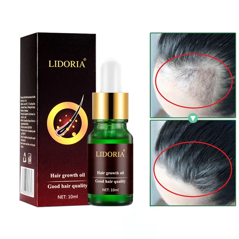 10ml Powerful Hair Growth Essence Products Conditioner Oil Treatment Preventing Hair Loss Hair Care Repairing Regenerating Serum
10ml Powerful Hair Growth Essence Products Conditioner Oil Treatment Preventing Hair Loss Hair Care Repairing Regenerating Serum