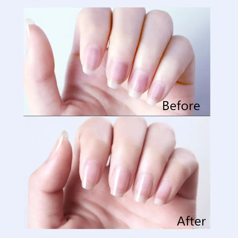 Nail Care Nutritional Oil Cuticle Remover Oil Activation Must Nourish Skin Softening Nail Polish Multi-color Nail Care Oil
Nail Care Nutritional Oil Cuticle Remover Oil Activation Must Nourish Skin Softening Nail Polish Multi-color Nail Care Oil