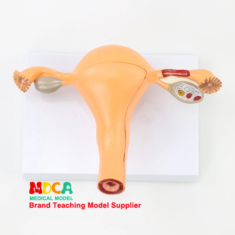 Medical teaching of anatomical model of uterus and genitalia in family planning of human uterus and reproductive model MSZXT005
Medical teaching of anatomical model of uterus and genitalia in family planning of human uterus and reproductive model MSZXT005