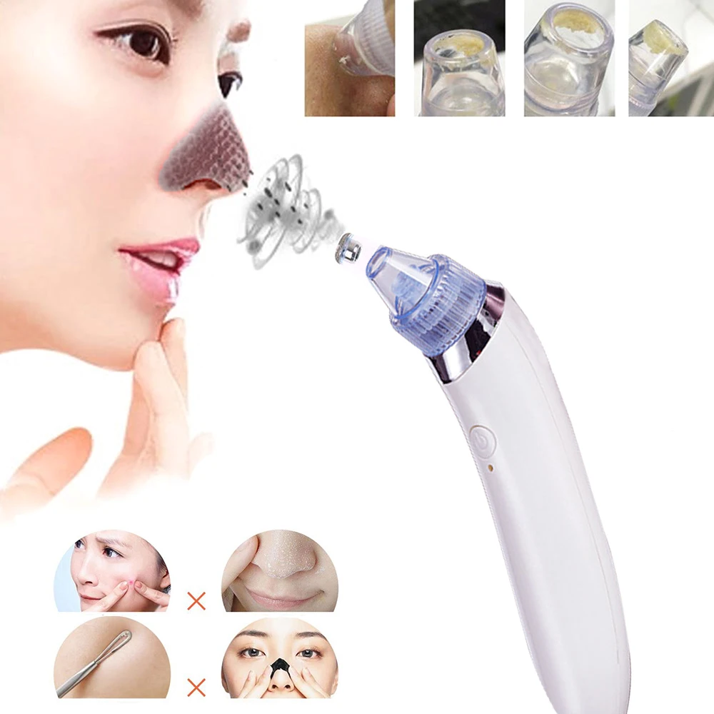 Facial Blackhead Vacuum Pore Suction Blackhead Removal Spot Cleaner Acne Remover Beauty Facial Pore Cleaner Machine
Facial Blackhead Vacuum Pore Suction Blackhead Removal Spot Cleaner Acne Remover Beauty Facial Pore Cleaner Machine