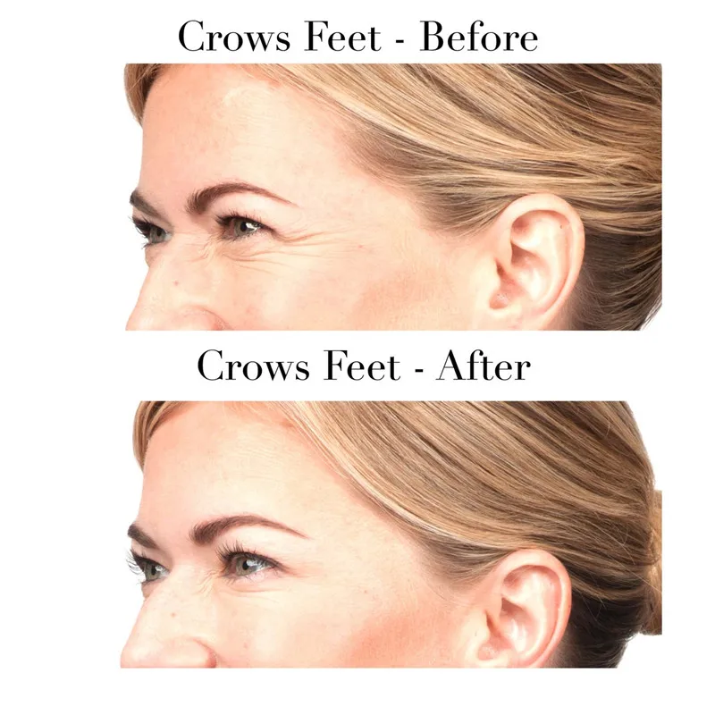 Fast Anti wrinkle eye cream 30g eye essence cream anti-puffiness finelines magic eye skin care anti aging essence eyes care
Fast Anti wrinkle eye cream 30g eye essence cream anti-puffiness finelines magic eye skin care anti aging essence eyes care