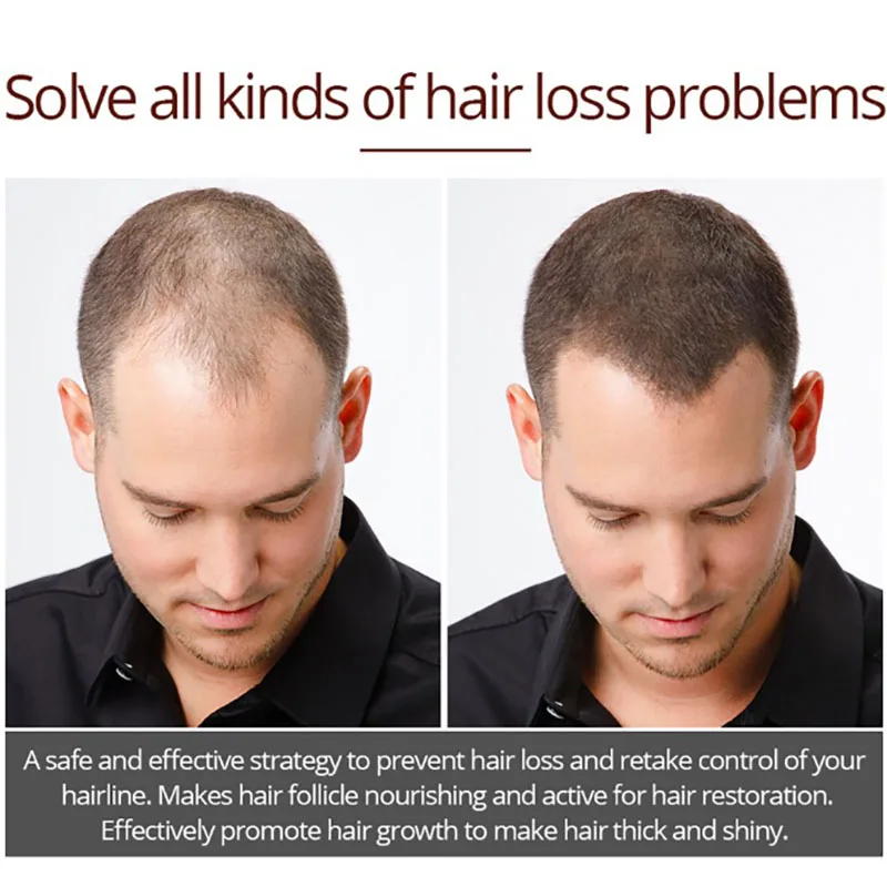 Thick Hair Spray Essence Hair Fast Growth Treatment Nourishing Prevent Hair Loss Product Liquid Hair Care Oil
Thick Hair Spray Essence Hair Fast Growth Treatment Nourishing Prevent Hair Loss Product Liquid Hair Care Oil