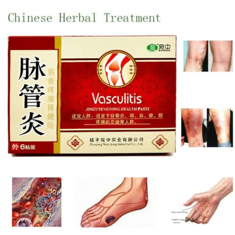 6Pcs Chinese Traditional Herbal Medicine Patches Cure Spider Veins Varicose Treatment Plaster Varicose Veins Vasculitis Natural
6Pcs Chinese Traditional Herbal Medicine Patches Cure Spider Veins Varicose Treatment Plaster Varicose Veins Vasculitis Natural