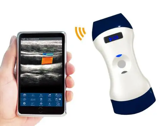 Double Heads Wireless Doppler Ultrasound Scanner for Hospital, Clinic, Veterinary
Double Heads Wireless Doppler Ultrasound Scanner for Hospital, Clinic, Veterinary