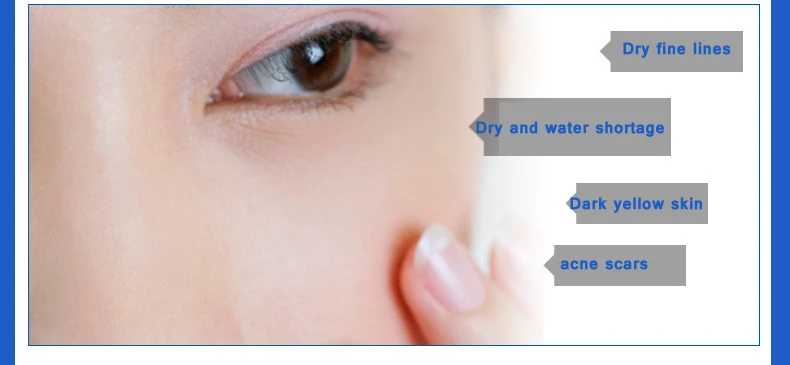 LAIKOU 3 In 1 Lady Face Whitening Deep Moisture Facial Mask Natural Essence Collagen Mask Hyaluronic Acid Bright Skin Masks
LAIKOU 3 In 1 Lady Face Whitening Deep Moisture Facial Mask Natural Essence Collagen Mask Hyaluronic Acid Bright Skin Masks