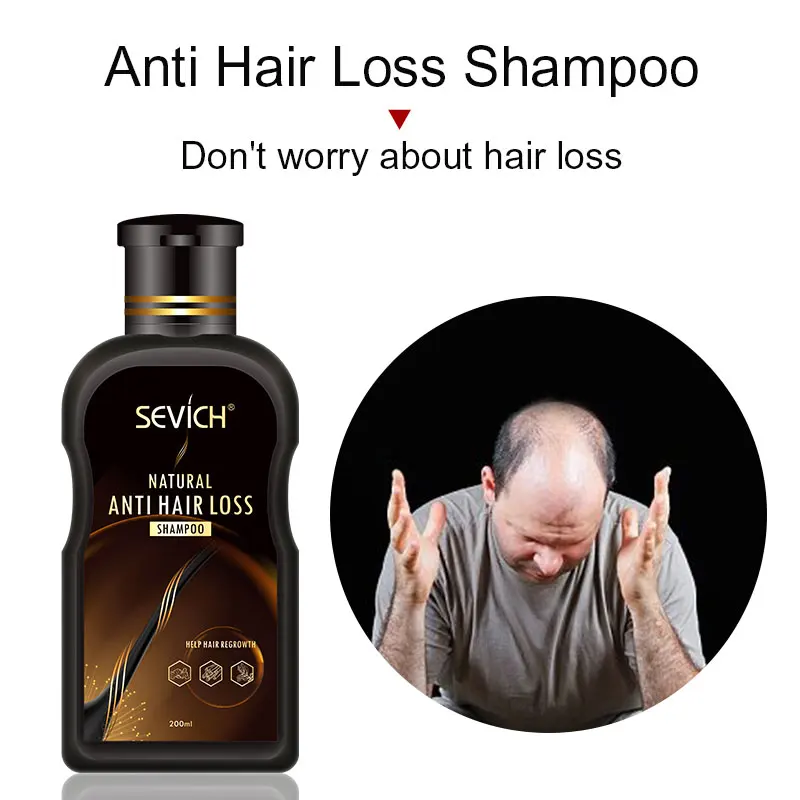 Sevich 200ml Ginger Hair shampoo Natural Anti-hair loss shampoo hair loss treatment Hair Growth
Sevich 200ml Ginger Hair shampoo Natural Anti-hair loss shampoo hair loss treatment Hair Growth