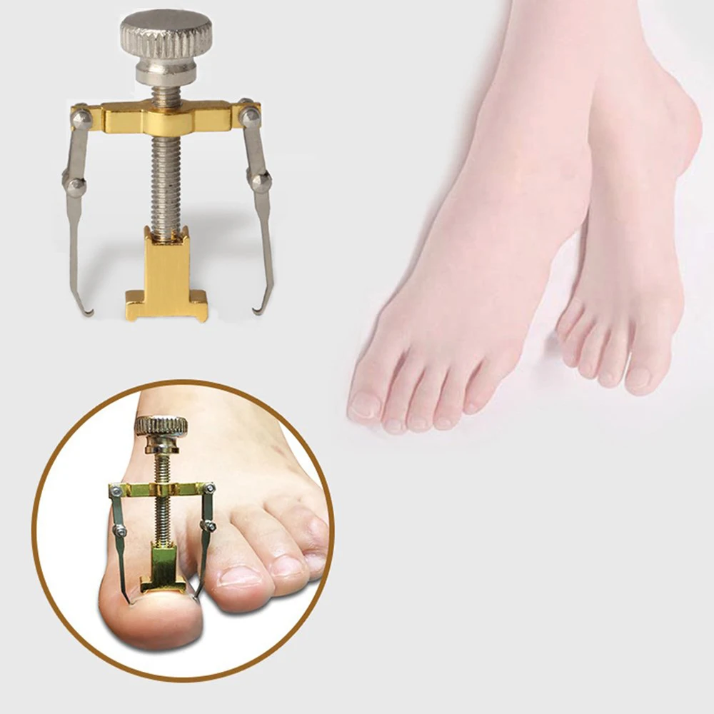 педикюр вросший ноготь Ingrown Toe корректор для педикюра инструмент для ухода за ногами бандаж для ногтей набор машина для детоксикации Onyxis Bunion...
педикюр вросший ноготь Ingrown Toe корректор для педикюра инструмент для ухода за ногами бандаж для ногтей набор машина для детоксикации Onyxis Bunion...