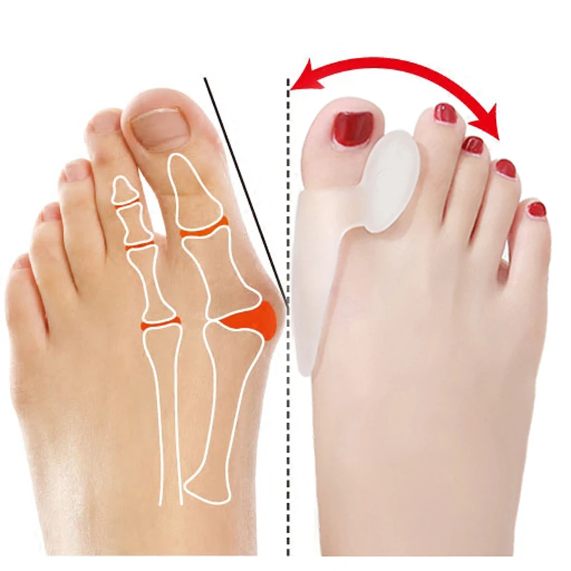 1pair Silicone Foot Massager Toe Separator Fingers Thumb Valgus Protector Bunion Adjuster Hallux Valgus Guard Feet Care Tools
1pair Silicone Foot Massager Toe Separator Fingers Thumb Valgus Protector Bunion Adjuster Hallux Valgus Guard Feet Care Tools
