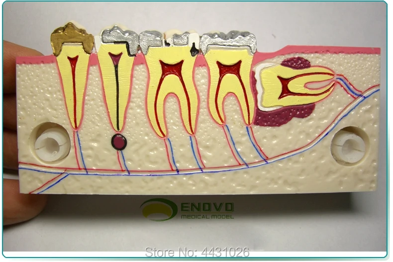 ENOVO The oral cavity of the tooth anatomy model of the lower right posterior teeth
ENOVO The oral cavity of the tooth anatomy model of the lower right posterior teeth