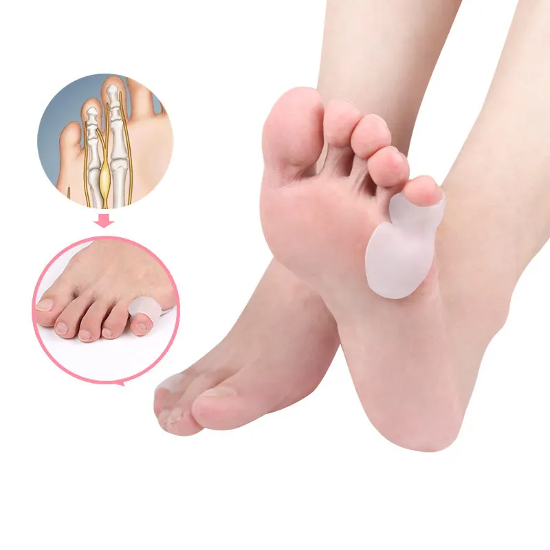 1 Pair Silicone Toe Correction Pad Overlap Toe Thumb Separator Daily Use Toe Bunion Protector Hallux Valgus Corrector One Size
1 Pair Silicone Toe Correction Pad Overlap Toe Thumb Separator Daily Use Toe Bunion Protector Hallux Valgus Corrector One Size