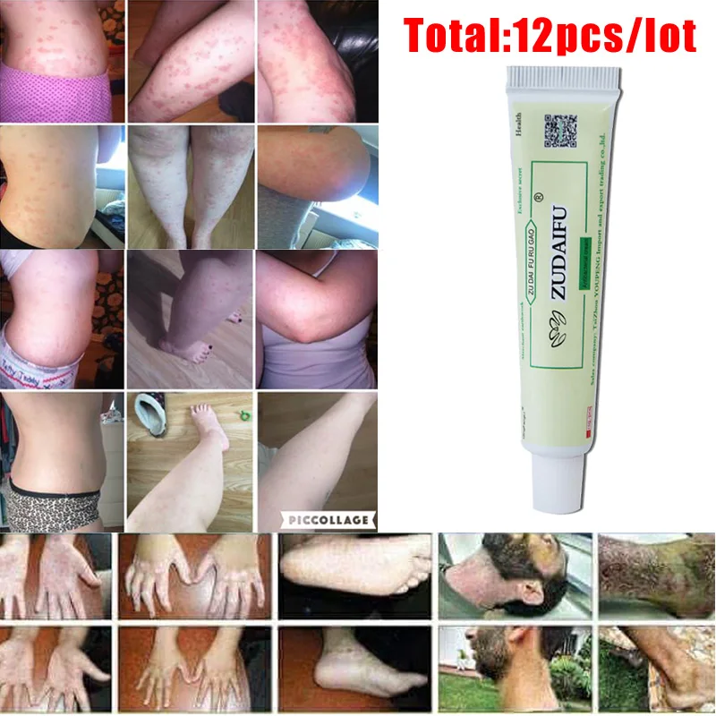 ZUDAIFU 12 шт. в лоте состояние кожи эффективное удаление псориаз экзема лечение пилинга антигрибок без розничной коробки
ZUDAIFU 12 шт. в лоте состояние кожи эффективное удаление псориаз экзема лечение пилинга антигрибок без розничной коробки
