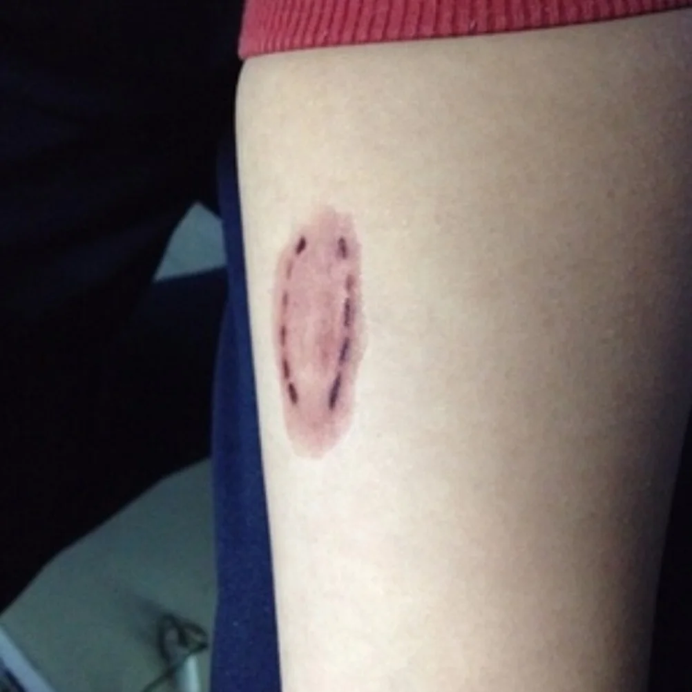Waterproof Temporary Tattoo Sticker Halloween Terror Wound Realistic Blood Injury Scar Fake Tattoo Sticker
Waterproof Temporary Tattoo Sticker Halloween Terror Wound Realistic Blood Injury Scar Fake Tattoo Sticker