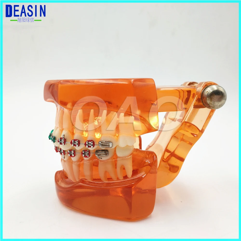 Teeth Model with Metal & Ceramic Brackets Irregular Tooth Ortho Metal Dentist Patient Student
Teeth Model with Metal & Ceramic Brackets Irregular Tooth Ortho Metal Dentist Patient Student