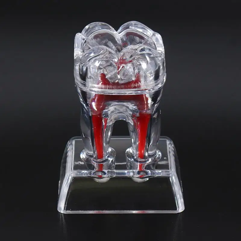 Large Tooth Molar Model Separable Teaching Demonstration Model Transparent Dentistry Material Dental Lab Teeth Model
Large Tooth Molar Model Separable Teaching Demonstration Model Transparent Dentistry Material Dental Lab Teeth Model
