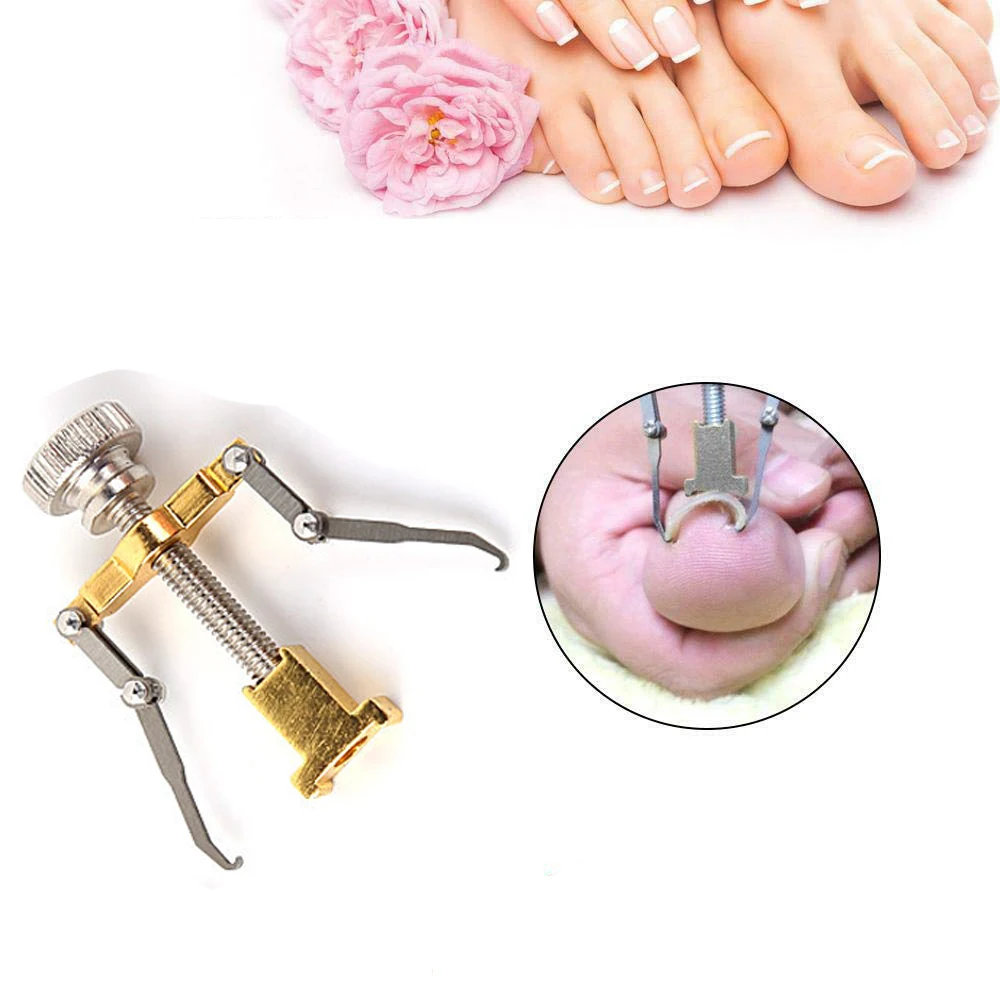 Ingrown Toenails Pedicure Correction Foot Nail Care Tool File Feet Orthotic Acronyx Ingrowing Nail Onyxis Bunion Corrector Toes
Ingrown Toenails Pedicure Correction Foot Nail Care Tool File Feet Orthotic Acronyx Ingrowing Nail Onyxis Bunion Corrector Toes