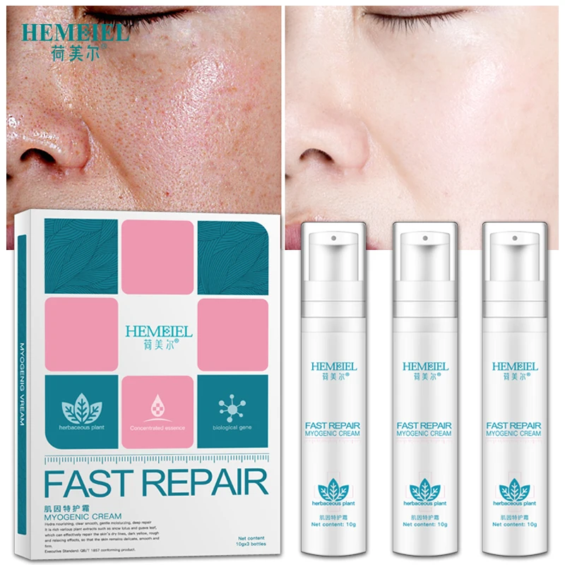 HEMEIEL Repairing Face Cream Moisturizing Anti Acne Whitening Facial Cream Relieve The Redness Sensitive Skin Care 3PCs
HEMEIEL Repairing Face Cream Moisturizing Anti Acne Whitening Facial Cream Relieve The Redness Sensitive Skin Care 3PCs