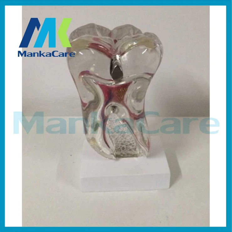 Manka Care - Anatomical odontologia Human Anatomical Pathological Study Tooth Disease Teeth Model skeleton for sale
Manka Care - Anatomical odontologia Human Anatomical Pathological Study Tooth Disease Teeth Model skeleton for sale