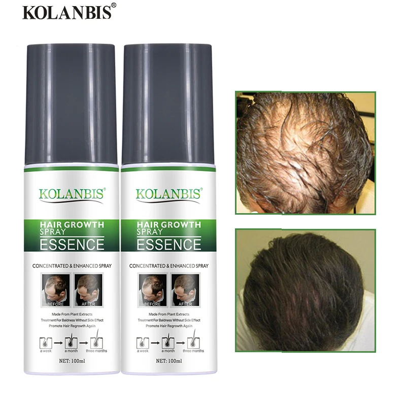2 bottle Permanent Hair Growth Tonic Fast Thickener Hair Loss Treatment Serum Anti Thinning Baldness Rebuild Chinese Medicine
2 bottle Permanent Hair Growth Tonic Fast Thickener Hair Loss Treatment Serum Anti Thinning Baldness Rebuild Chinese Medicine