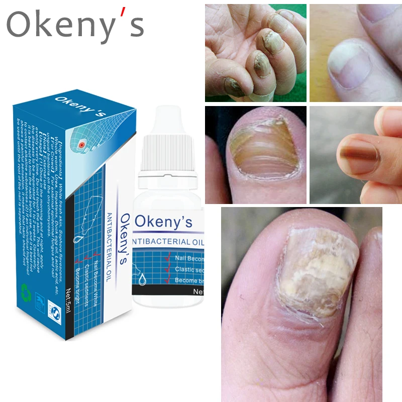 Nail Repair Essence Nail Fungus Removal Anti Onychomycosis Feet Care Treatment With Foot File Nail Repair Liquid
Nail Repair Essence Nail Fungus Removal Anti Onychomycosis Feet Care Treatment With Foot File Nail Repair Liquid